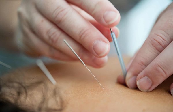 Quelles sont les solutions alternatives en médecine douce ?